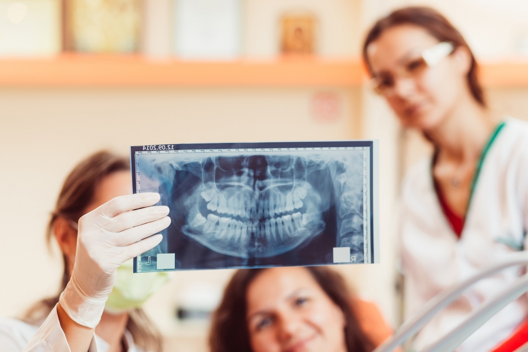 Step-by-Step Guide to Dental X-rays